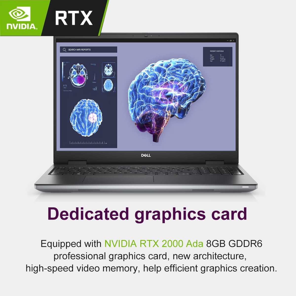 Dell Precision 7000 7680 Mobile Workstation Laptop (NVIDIA RTX 2000 Ada 8GB, 16' FHD+, Intel Core i7-13850HX (> Ultra 9-185H), 64GB LPCAMM2 DDR5, 1TB SSD) Pro Max for Designer, Engineer, Win 11 Pro